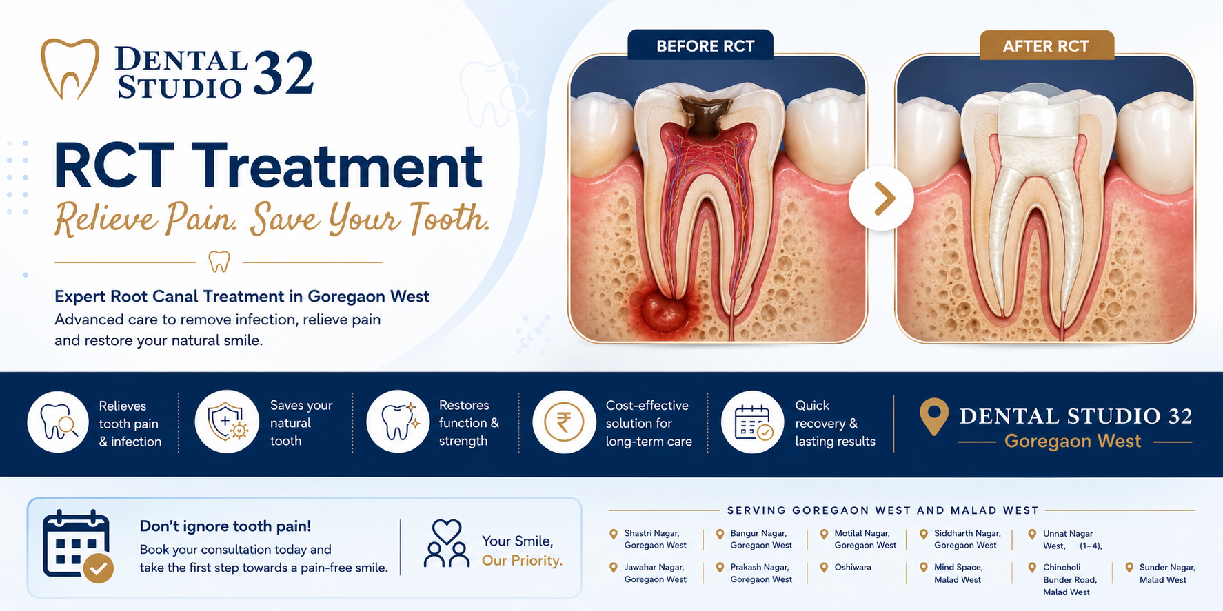 Before and after root canal treatment at Dental Studio 32 Goregaon West — infected tooth saved with RCT